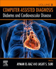 Diabetes and Cardiovascular Disease (Paperback) 9780128174289