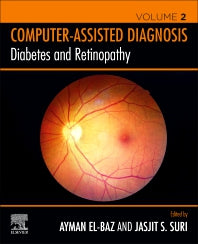 Diabetes and Retinopathy (Paperback) 9780128174388