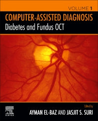 Diabetes and Fundus OCT (Paperback) 9780128174401