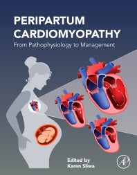 Peripartum Cardiomyopathy; From Pathophysiology to Management (Paperback) 9780128176672