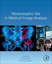 Neutrosophic Set in Medical Image Analysis (Paperback) 9780128181485