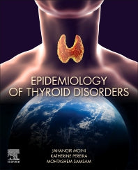 Epidemiology of Thyroid Disorders (Paperback) 9780128185001