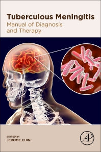 Tuberculous Meningitis; Manual of Diagnosis and Therapy (Paperback) 9780128188255