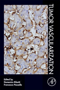 Tumor Vascularization (Paperback) 9780128194942