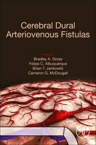 Cerebral Dural Arteriovenous Fistulas (Paperback) 9780128195253