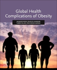 Global Health Complications of Obesity (Paperback) 9780128197516