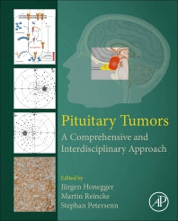 Pituitary Tumors; A Comprehensive and Interdisciplinary Approach (Hardback) 9780128199497
