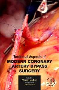 Technical Aspects of Modern Coronary Artery Bypass Surgery (Paperback) 9780128203484