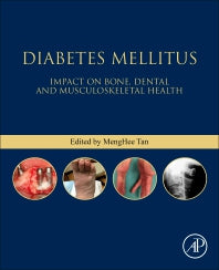 Diabetes Mellitus; Impact on Bone, Dental and Musculoskeletal Health (Paperback) 9780128206058