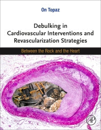 Debulking in Cardiovascular Interventions and Revascularization Strategies; Between a Rock and the Heart (Paperback) 9780128214510