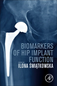 Biomarkers of Hip Implant Function (Paperback) 9780128215968