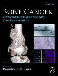 Bone Cancer; Bone Sarcomas and Bone Metastases - From Bench to Bedside (Hardback) 9780128216668