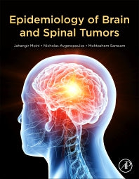 Epidemiology of Brain and Spinal Tumors (Hardback) 9780128217368