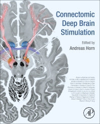 Connectomic Deep Brain Stimulation (Paperback) 9780128218617