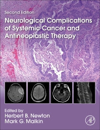 Neurological Complications of Systemic Cancer and Antineoplastic Therapy (Hardback) 9780128219768