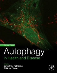 Autophagy in Health and Disease (Paperback) 9780128220030