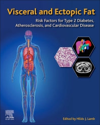 Visceral and Ectopic Fat; Risk Factors for Type 2 Diabetes, Atherosclerosis, and Cardiovascular Disease (Paperback) 9780128221860