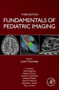 Fundamentals of Pediatric Imaging (Hardback) 9780128222553