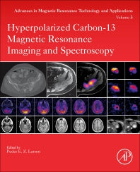 Hyperpolarized Carbon-13 Magnetic Resonance Imaging and Spectroscopy (Paperback) 9780128222690