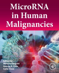 MicroRNA in Human Malignancies (Paperback) 9780128222874