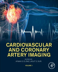 Cardiovascular and Coronary Artery Imaging; Volume 1 (Paperback) 9780128227060