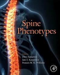 Spine Phenotypes (Hardback) 9780128227787