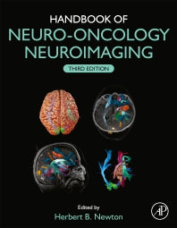 Handbook of Neuro-Oncology Neuroimaging (Hardback) 9780128228357