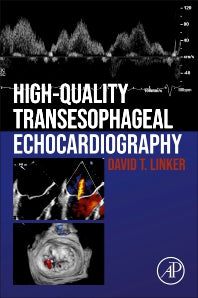 High-Quality Transesophageal Echocardiography (Paperback) 9780128229323