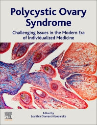 Polycystic Ovary Syndrome; Challenging Issues in the Modern Era of Individualized Medicine (Paperback) 9780128230459