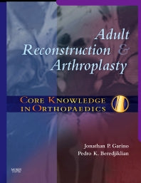 Core Knowledge in Orthopaedics: Adult Reconstruction and Arthroplasty (Hardback) 9780323033701