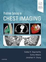 Problem Solving in Chest Imaging (Hardback) 9780323041324