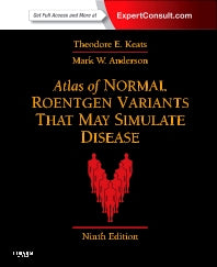 Atlas of Normal Roentgen Variants That May Simulate Disease; Expert Consult - Enhanced Online Features and Print (Hardback) 9780323073554