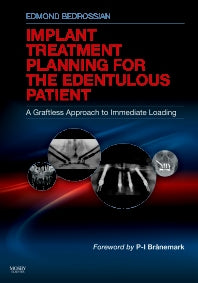 Implant Treatment Planning for the Edentulous Patient; A Graftless Approach to Immediate Loading (Hardback) 9780323073684