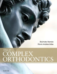 Atlas of Complex Orthodontics (Hardback) 9780323087100