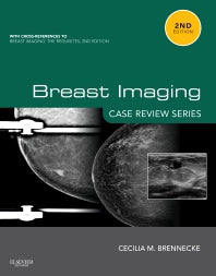 Breast Imaging: Case Review Series (Paperback / softback) 9780323087223