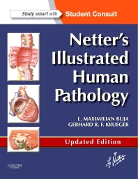 Netter's Illustrated Human Pathology Updated Edition; with Student Consult Access (Paperback) 9780323220897