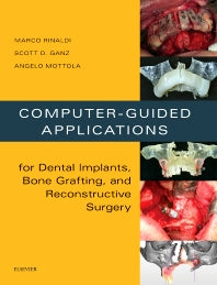 Computer-Guided Applications for Dental Implants, Bone Grafting, and Reconstructive Surgery (adapted translation) (Hardback) 9780323278034