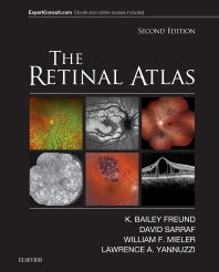 The Retinal Atlas (Hardback) 9780323287920