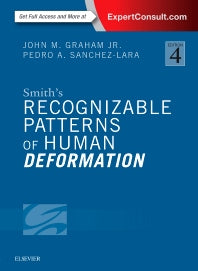 Smith's Recognizable Patterns of Human Deformation (Hardback) 9780323294942