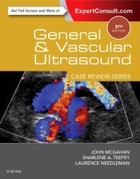 General and Vascular Ultrasound: Case Review (Paperback / softback) 9780323296144