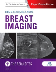 Breast Imaging: The Requisites (Hardback) 9780323329040
