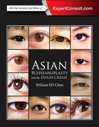 Asian Blepharoplasty and the Eyelid Crease (Hardback) 9780323355728
