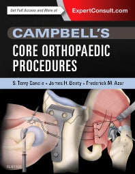 Campbell's Core Orthopaedic Procedures (Hardback) 9780323357630