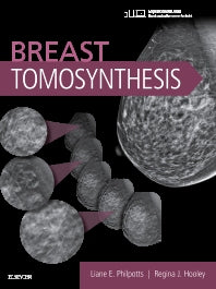 Breast Tomosynthesis (Hardback) 9780323358279