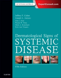 Dermatological Signs of Systemic Disease (Hardback) 9780323358293