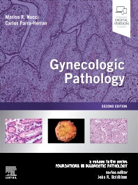 Gynecologic Pathology; A Volume in Foundations in Diagnostic Pathology Series (Hardback) 9780323359092