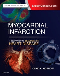 Myocardial Infarction: A Companion to Braunwald's Heart Disease (Hardback) 9780323359436