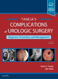 Complications of Urologic Surgery; Prevention and Management (Hardback) 9780323392426