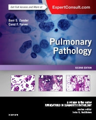 Pulmonary Pathology; A Volume in the Series: Foundations in Diagnostic Pathology (Hardback) 9780323393089