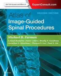 Atlas of Image-Guided Spinal Procedures (Hardback) 9780323401531